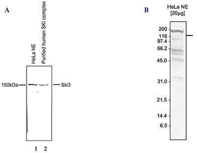 Western Blot: TTC37 Antibody [NBP2-59165]