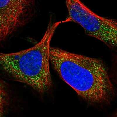 Immunocytochemistry/ Immunofluorescence: TTC38 Antibody [NBP1-82163]