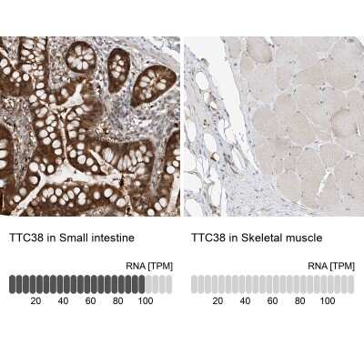 Immunohistochemistry-Paraffin: TTC38 Antibody [NBP1-82163]