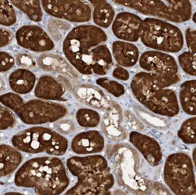 Immunohistochemistry-Paraffin: TTC38 Antibody [NBP1-82163]