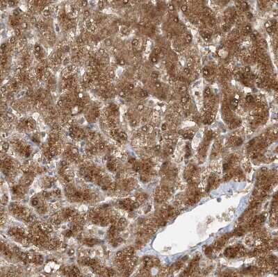 Immunohistochemistry-Paraffin: TTC38 Antibody [NBP1-82163]