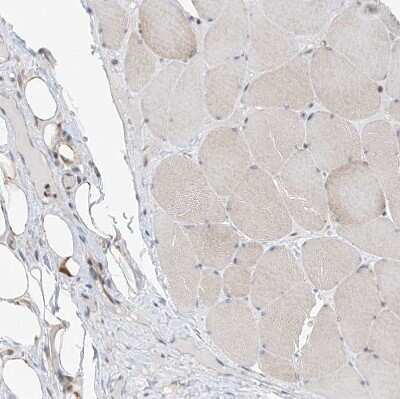 Immunohistochemistry-Paraffin: TTC38 Antibody [NBP1-82163]