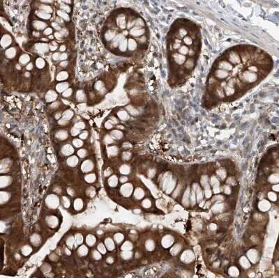 Immunohistochemistry-Paraffin: TTC38 Antibody [NBP1-82163]