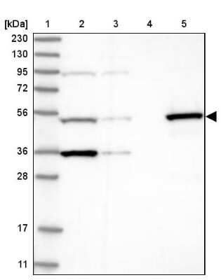 Western Blot: TTC38 Antibody [NBP1-82163]
