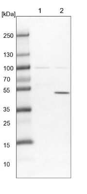 Western Blot: TTC38 Antibody [NBP1-82163]