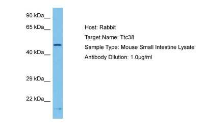 Western Blot: TTC38 Antibody [NBP2-83724]