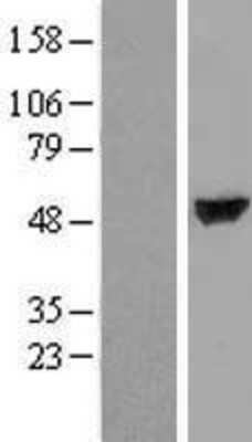 Western Blot: TTC38 Overexpression Lysate [NBL1-17410]