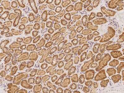 Immunohistochemistry-Paraffin: TTC39A Antibody [NBP2-98189]