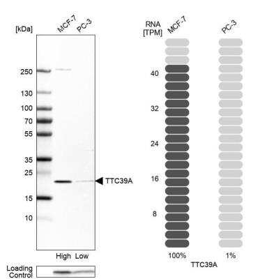 Western Blot: TTC39A Antibody [NBP1-88333]