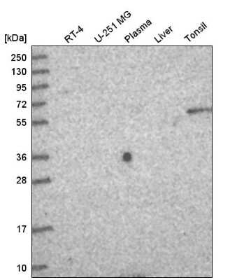 Western Blot: TTC39A Antibody [NBP2-58703]