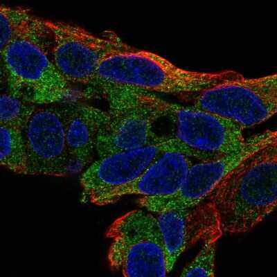 Immunocytochemistry/ Immunofluorescence: TTC39B Antibody [NBP2-55809]