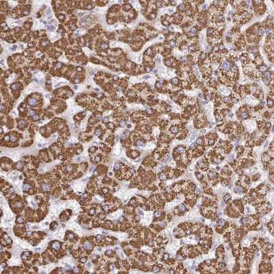 Immunohistochemistry: TTC39B Antibody [NBP2-49150]