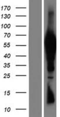 Western Blot: TTC39B Overexpression Lysate [NBP2-05340]