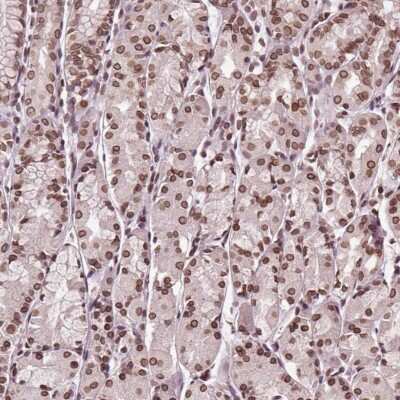Immunohistochemistry: TTC39C Antibody [NBP2-49458]