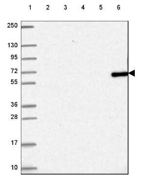 Western Blot: TTC39C Antibody [NBP2-49458]