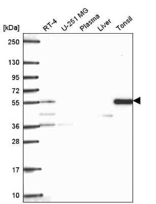 Western Blot: TTC39C Antibody [NBP2-56001]