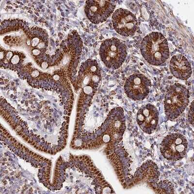 Immunohistochemistry-Paraffin: TTC4 Antibody [NBP1-81905]