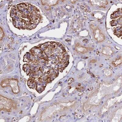 Immunohistochemistry-Paraffin: TTC4 Antibody [NBP1-81906]