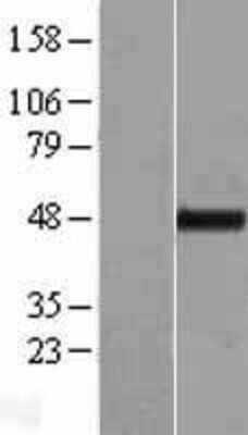 Western Blot: TTC4 Overexpression Lysate [NBL1-17411]