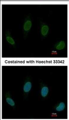 Immunocytochemistry/ Immunofluorescence: TTC40 Antibody [NBP2-15632]