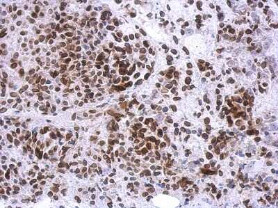 Immunohistochemistry-Paraffin: TTC40 Antibody [NBP2-15632]