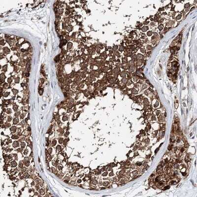 Immunohistochemistry-Paraffin: TTC40 Antibody [NBP2-48697]