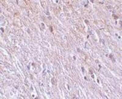 Immunohistochemistry-Paraffin: TTC5 Antibody - BSA Free [NBP1-76636]