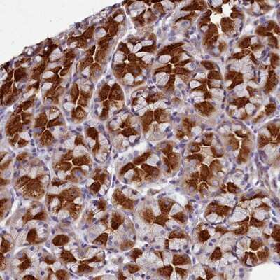 Immunohistochemistry-Paraffin: TTC5 Antibody [NBP1-92542]