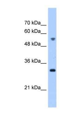 Western Blot: TTC5 Antibody [NBP1-53012]