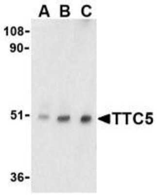 Western Blot: TTC5 AntibodyBSA Free [NBP1-76636]