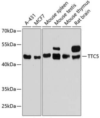 Western Blot: TTC5 AntibodyAzide and BSA Free [NBP2-93888]