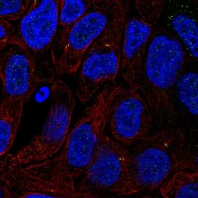 Immunocytochemistry/ Immunofluorescence: TTC6 Antibody [NBP2-49592]