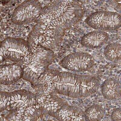 Immunohistochemistry-Paraffin: TTC7A Antibody [NBP1-93601]