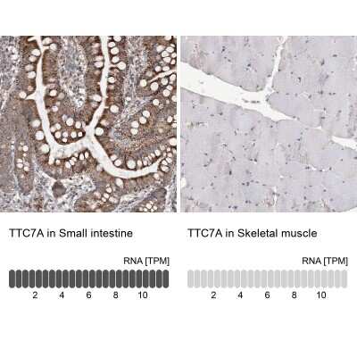 Immunohistochemistry-Paraffin: TTC7A Antibody [NBP1-93602]