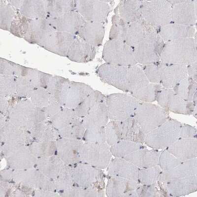 Immunohistochemistry-Paraffin: TTC7A Antibody [NBP1-93602]