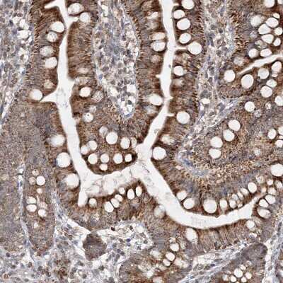 Immunohistochemistry-Paraffin: TTC7A Antibody [NBP1-93602]