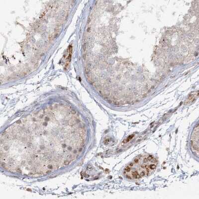 Immunohistochemistry-Paraffin: TTC7A Antibody [NBP1-93602]