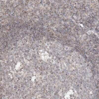 Immunohistochemistry-Paraffin: TTC7A Antibody [NBP1-93602]