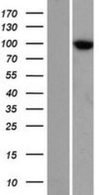 Western Blot: TTC7A Overexpression Lysate [NBP2-06642]