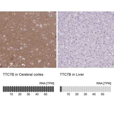 Immunohistochemistry-Paraffin: TTC7B Antibody [NBP2-31715]