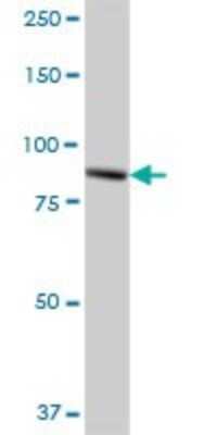 Western Blot: TTC7B Antibody [H00145567-B01P]