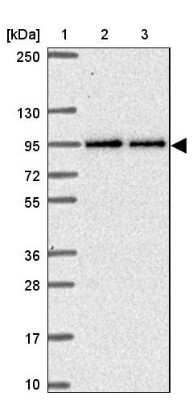 Western Blot: TTC7B Antibody [NBP2-31782]