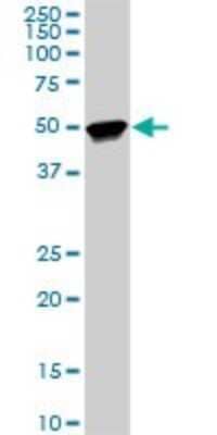 Western Blot: TTC8 Antibody (7E2) [H00123016-M03]