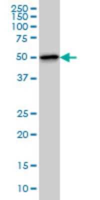 Western Blot: TTC8 Antibody (7E2) [H00123016-M03]