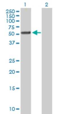 Western Blot: TTC8 Antibody [H00123016-B01P]