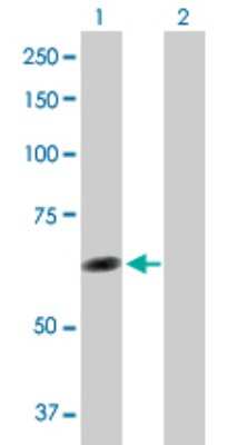 Western Blot: TTC8 Antibody [H00123016-D01P]