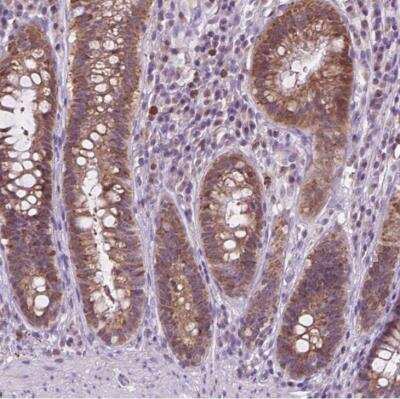 Immunohistochemistry-Paraffin: TTC9B Antibody [NBP1-82042]