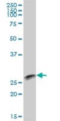 Western Blot: TTC9B Antibody [H00148014-B01P]