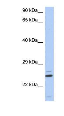 Western Blot: TTC9C Antibody [NBP1-55306]