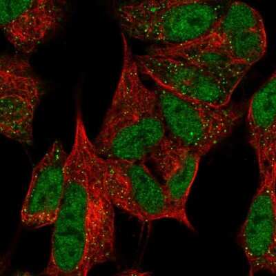 Immunocytochemistry/ Immunofluorescence: TTDN1 Antibody [NBP2-57000]